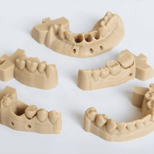 Custom 3D printed models used for crowns, bridges, and implant planning Custom 3D printed models used for crowns, bridges, and implant planning