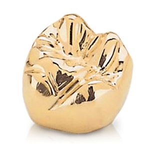 Dold dental crown crafted for superior durability and precise fit Gold dental crown crafted for superior durability and precise fit